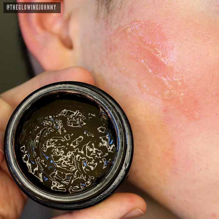 Fighter Gel - Breakout Calming Gel - Image 5