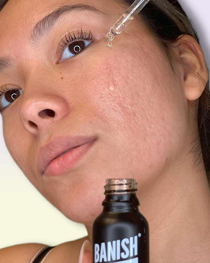 Banish Serum - Vitamin C Serum Dark Spot Corrector - Image 3